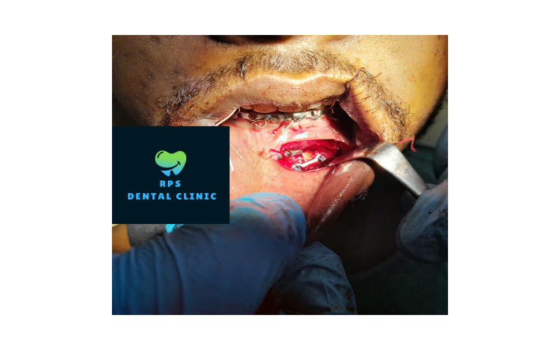 Emergency dental services