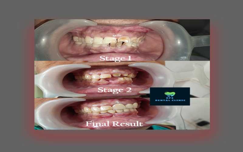 cosmetic dental treatment