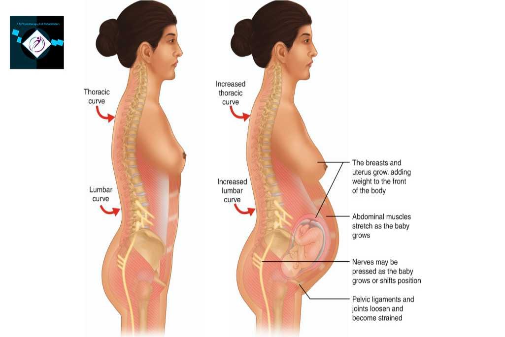 Pain due to Lumber Puncture
