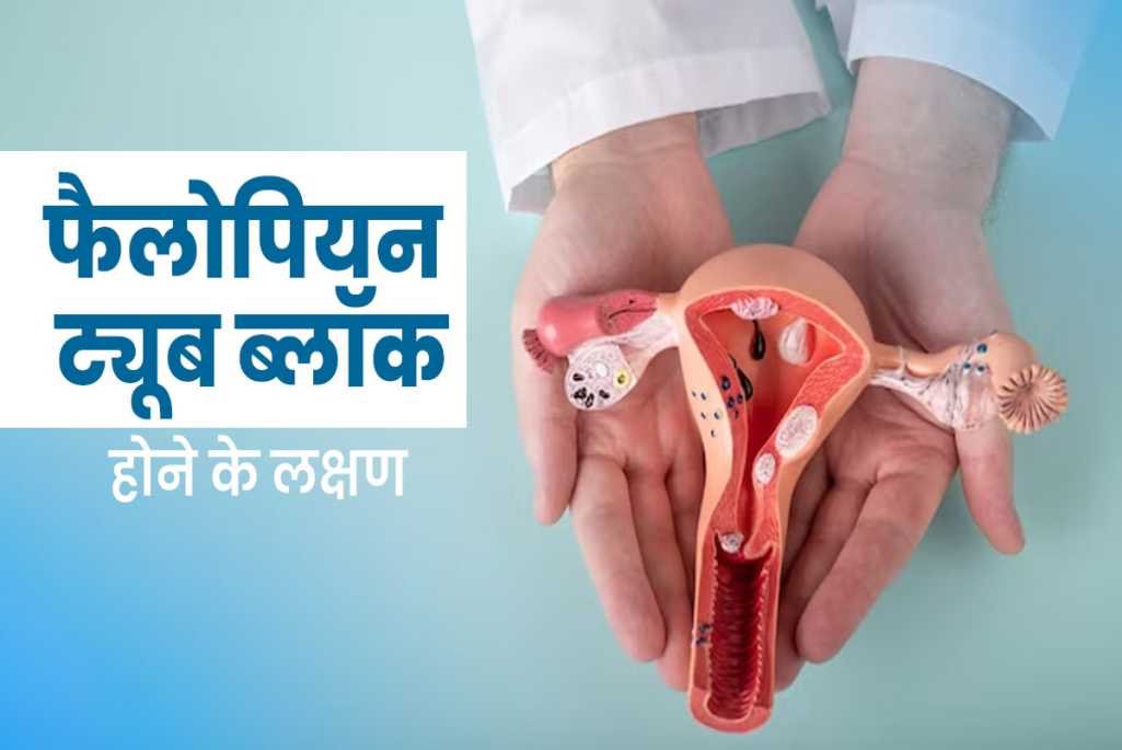 Fallopian Tube Problems