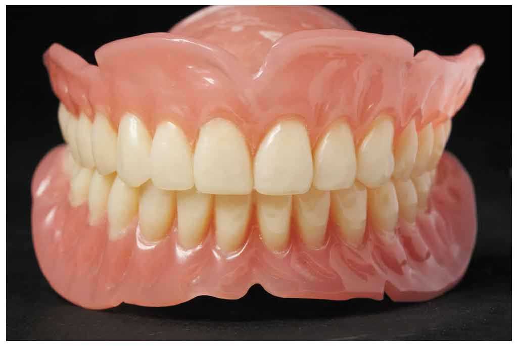 COMPLETE DENTURE
