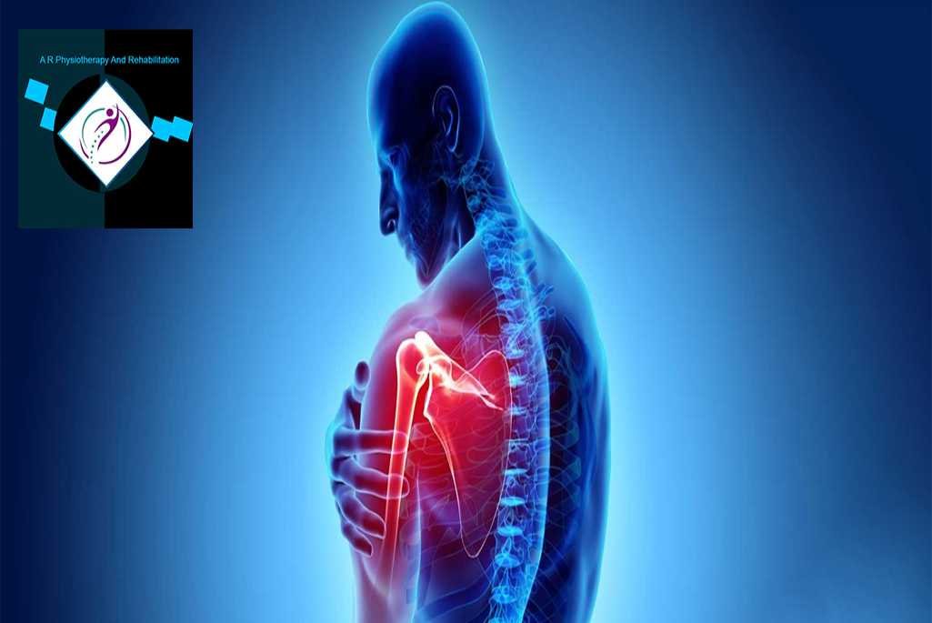 Per arthritis (shoulder pain)