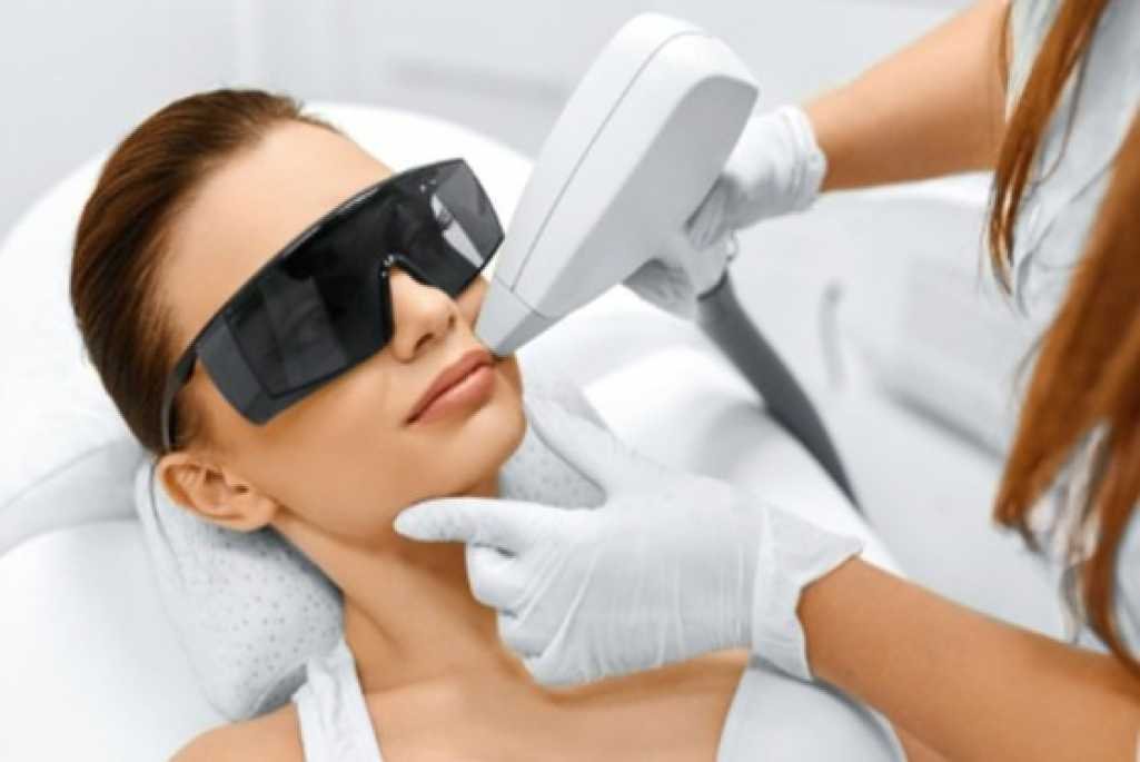 Laser Peal Treatment