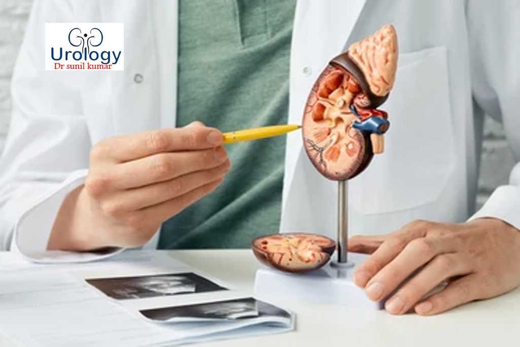 Kidney Stone Treatment